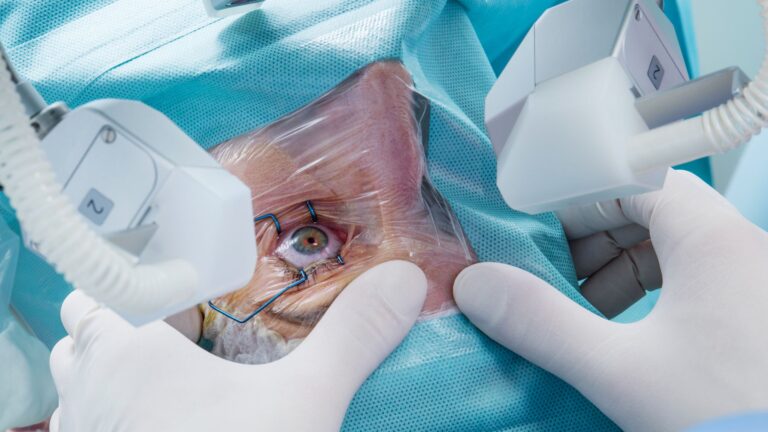 Exploring the Benefits of Advanced Technology Cataract Surgery
